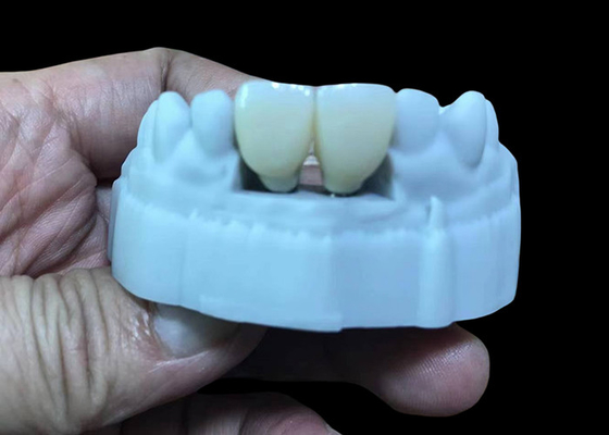 Bon prix Remplacez la couronne d'implant dentaire avec une base en titane et une couronne en zirconium. en ligne