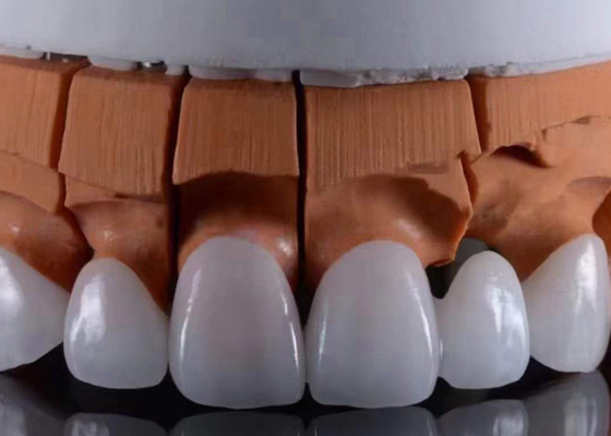 Bon prix La FDA approuve des couronnes dentaires translucides en zirconium, parfaitement adaptées à l'aspect esthétique naturel. en ligne