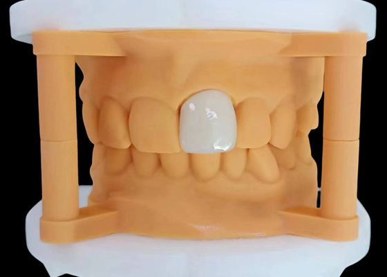 Bon prix Une couronne dentaire en zirconium translucide avec une performance esthétique du laboratoire dentaire chinois en ligne