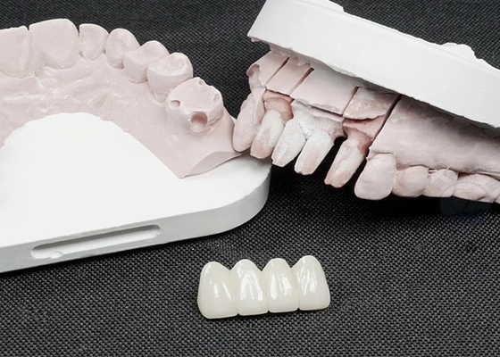 Bon prix Des couronnes dentaires en zirconium de qualité supérieure pour une résistance supérieure et une esthétique naturelle en ligne