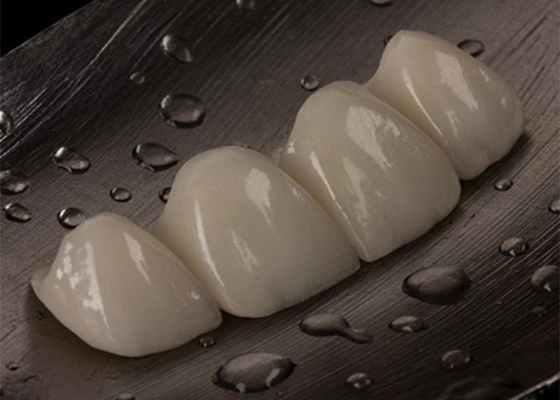 Bon prix Pont de couronne en céramique personnalisable pour une dent manquante Confortable et parfait en ligne
