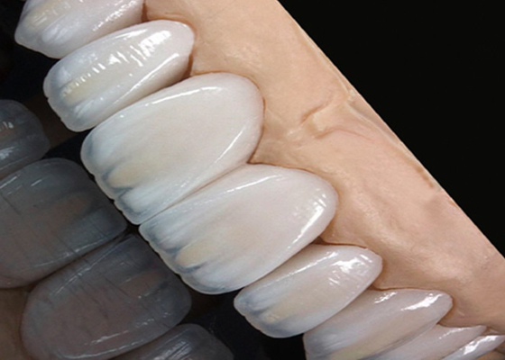 Bon prix Translucide pont de couronne en céramique résistant aux taches, parfait pour un sourire naturel en ligne