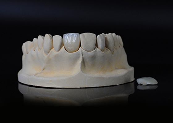 Bon prix Porcelaine translucide émax placage pour un ajustement excellent / esthétique naturelle en ligne