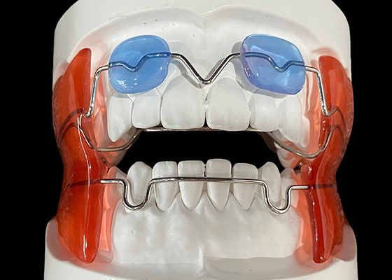 Bon prix Appareil d'orthodontie Frankel 2/3 pour améliorer l'alignement des mâchoires chez les enfants en croissance en ligne