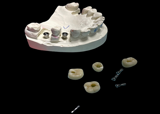 Bon prix Surface polie vis d'implant dentaire couronne retenue pour le remplacement des dents en ligne