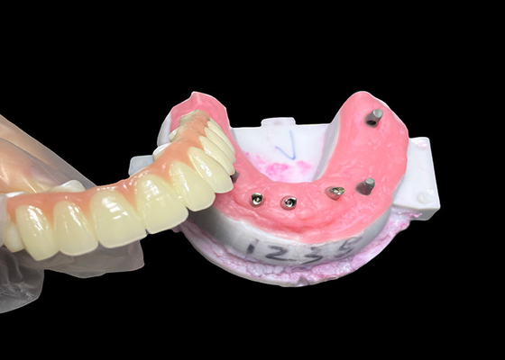 Bon prix Implant supporté Prothèse à pleine voûte Implant dentaire fixe Pont de couronne en céramique en ligne