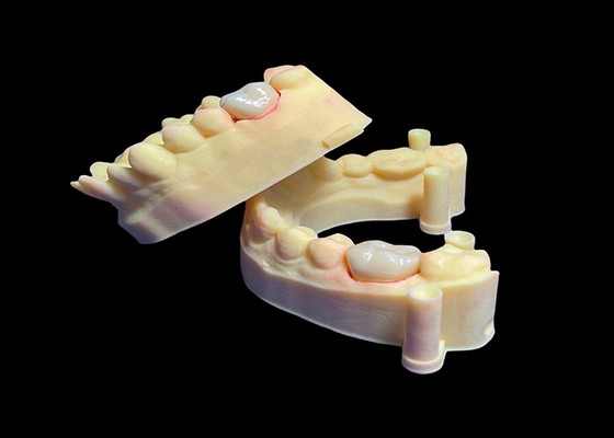 Bon prix Couronne dentaire en zirconium biocompatible pour dents simples ou multiples en ligne