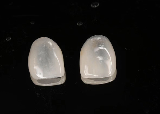 Bon prix Restauration esthétique Émax Faisceaux céramiques translucides avec surface polie en ligne