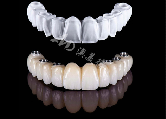 Bon prix Affordable, précise, couronne en zirconium, couronne dentaire en zirconium. en ligne