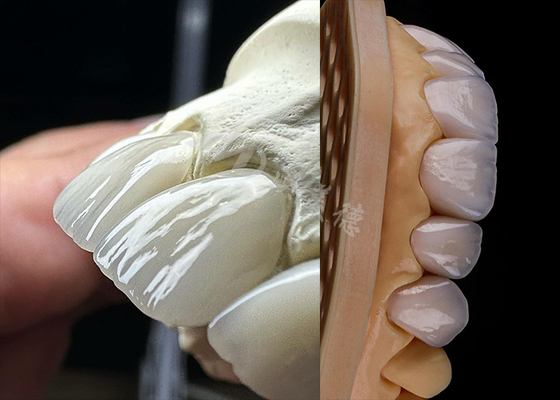 Bon prix Dentistique durable, couronne de zirconium solide, dentition de couronne de précision, laboratoire dentaire de zirconium. en ligne