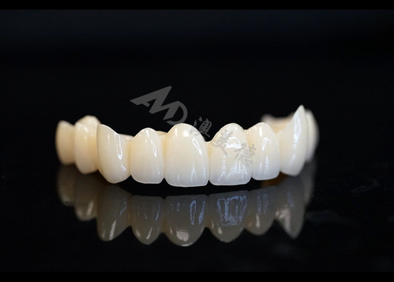 Bon prix Une couronne en zirconium solide réalisée avec précision pour une dentition et un confort parfaits. en ligne