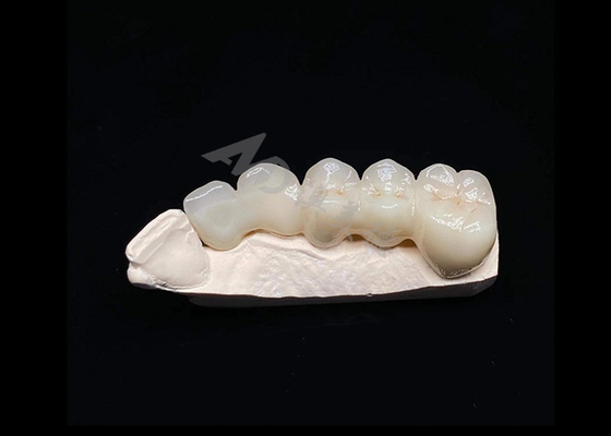Bon prix Translucide Esthétique naturelle Couronne en zirconium solide pour les dents Résistant aux fissures en ligne