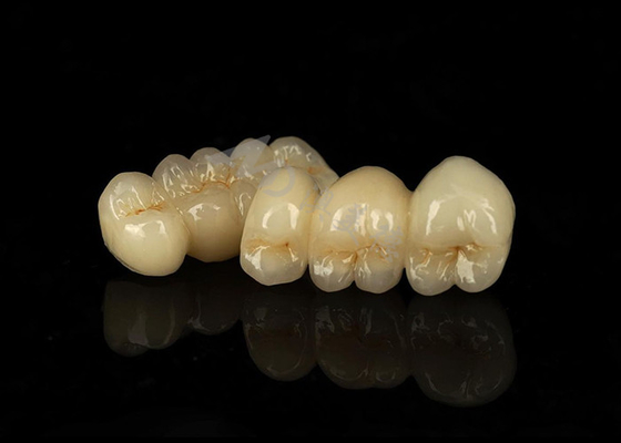 Bon prix Couronne en zirconium solide résistant aux taches combinant une excellente biocompatibilité en ligne