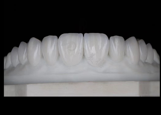 Bon prix Translucides couronnes en zirconium esthétique naturelle excellente biocompatibilité et résistance en ligne