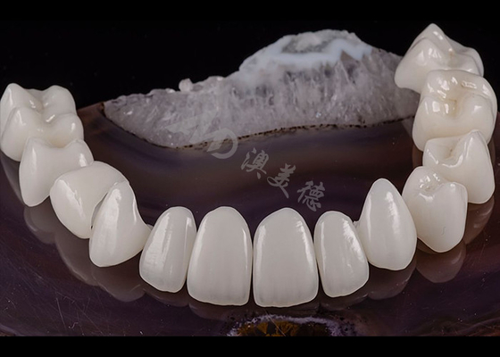 Bon prix Dentelle translucide Dentelle solide couronne de zirconium Esthétique naturelle Résistance aux fissures en ligne