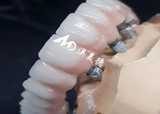Bon prix Des implants dentaires de haute performance exclusifs en ligne