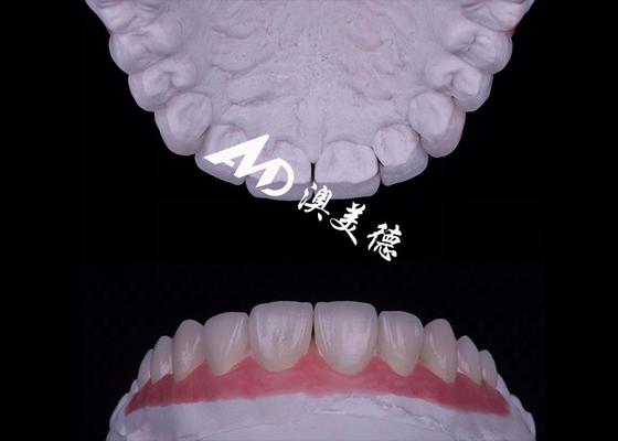 Bon prix Translucide Faisceau de porcelaine EMAX Résistant aux taches / résistance en ligne