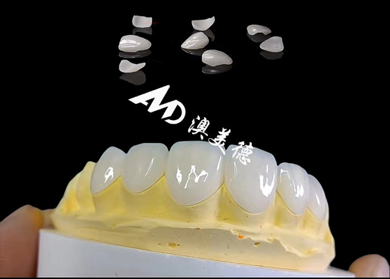 Bon prix Translucides IPS Faisceaux Emax, préparation minimale Faisceaux dentaires Emax en ligne