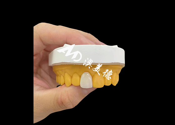 Bon prix Incisive antérieure couronne dentaire en zirconium apparence naturelle résistance à l'usure en ligne