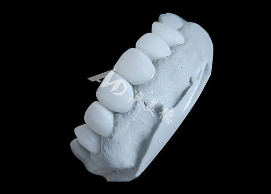 Bon prix Une couronne dentaire en zirconium offrant une résistance imbattable, une douceur naturelle et une translucide naturelle. en ligne