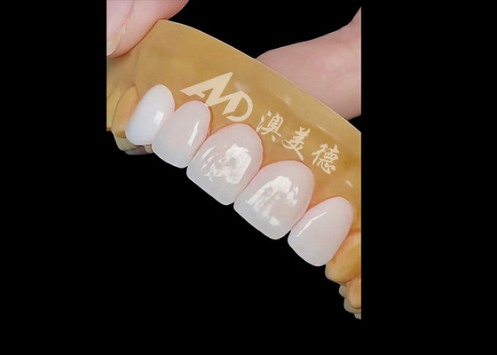 Bon prix Une couronne dentaire en zirconium de précision pour une restauration naturelle et durable en ligne