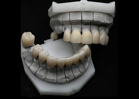 Bon prix Résistance à l'éclatement de la couronne dentaire en zirconium pour dents simples ou multiples en ligne