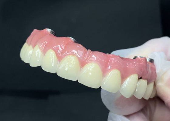 Bon prix Implants dentaires durables avec une coque en titane facile à nettoyer et une couronne en zirconium en ligne
