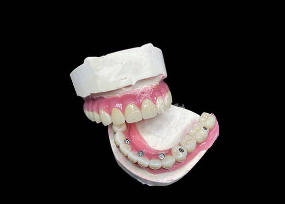 Bon prix Le pont de la couronne pour les dents manquantes. en ligne