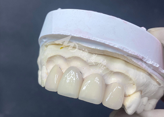 Bon prix Les facettes dentaires sont fabriquées avec précision, elles sont parfaitement ajustées et très translucides pour un sourire parfait. en ligne