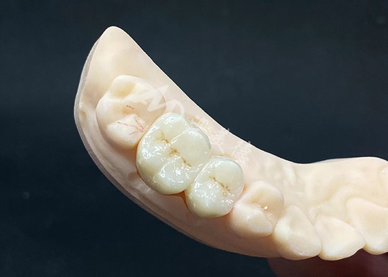Bon prix Couronne en zirconium à haute translucide, conception naturelle et résistante aux fissures en ligne