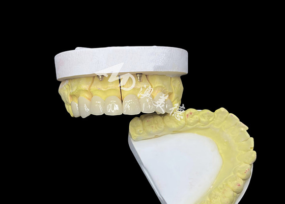 Bon prix Réalisez un sourire parfait avec des couronnes dentaires en céramique de haute qualité pour une apparence naturelle et une résistance durable en ligne