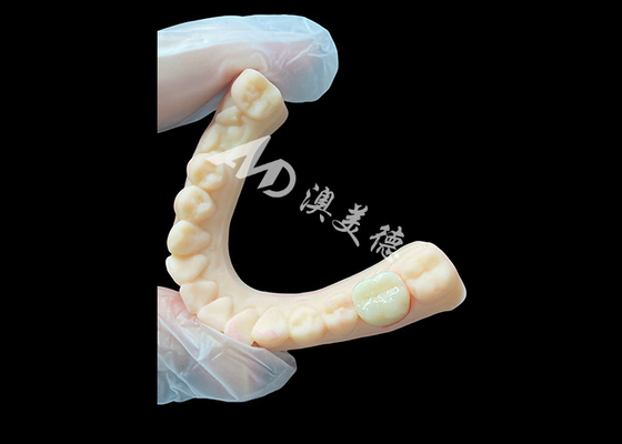 Bon prix Couronne dentaire postérieure en céramique de zirconium de haute résistance en ligne