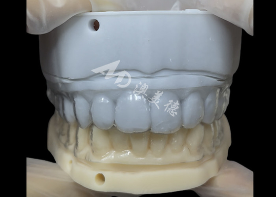 Bon prix Retenant orthodontique Essix Retenant simple et polyvalent Correction en ligne
