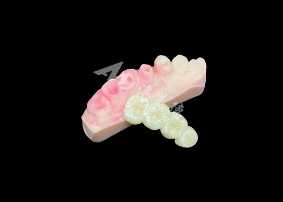 Bon prix Pont de couronne en zirconium solide supérieur pour une esthétique dentaire naturelle en ligne
