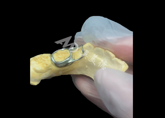 Bon prix Le maintien de l'espace orthodontique est un dispositif inestimable qui protège ingénieusement les espaces entre les dents des enfants, assurant un bon développement des dents. en ligne