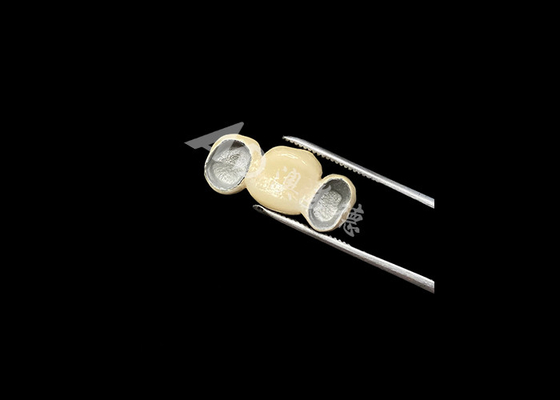 Bon prix Une porcelaine bien ajustée fondue dans une couronne métallique avec une excellente biocompatibilité en ligne