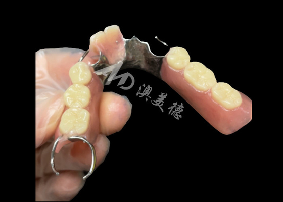 Bon prix Dentures partielles en titane coulées avec fermetures reposant avec les dents en ligne