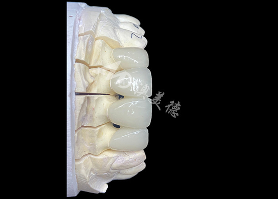 Bon prix Le pont à couronne en céramique de zirconie, d'apparence naturelle, offre une précision et une esthétique combinées en ligne