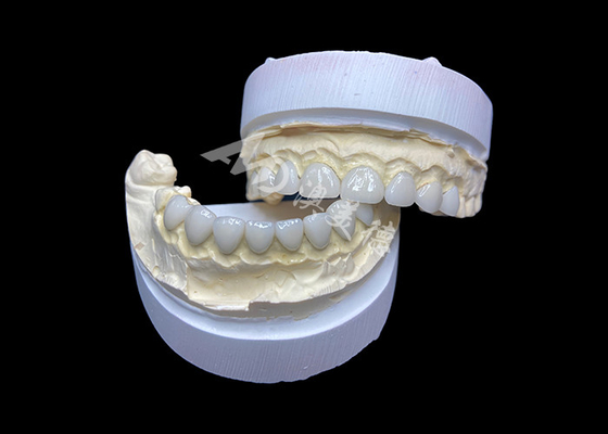 Bon prix Personnalisation Faisceaux en verre céramique ultra mince Haute translucide pour un sourire naturel en ligne