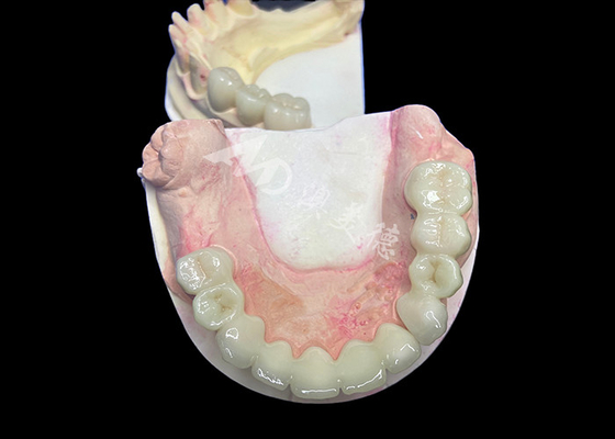 Bon prix Une couronne de zirconium de lave d'apparence naturelle avec une durabilité inégalée en ligne