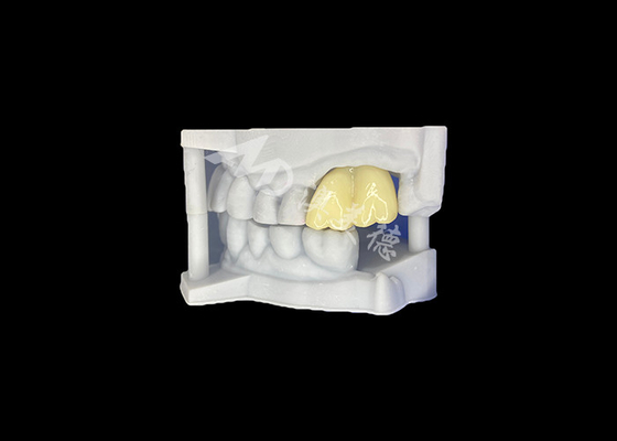 Bon prix Une couronne dentaire en zirconium solide, durabilité garantie, molarité de laboratoire dentaire chinois. en ligne