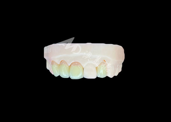 Bon prix Naturel et confortable Adapté Circonia Porcelaine Couronne Chine Dental Laboratoire personnalisable en ligne
