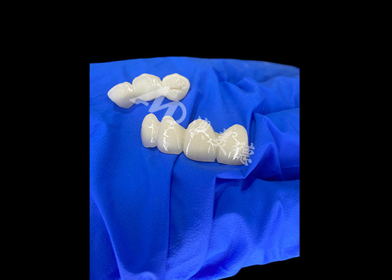 Bon prix Wieland Zenostar Ceramic Crown Bridge haute précision pour des restaurations durables et naturelles en ligne