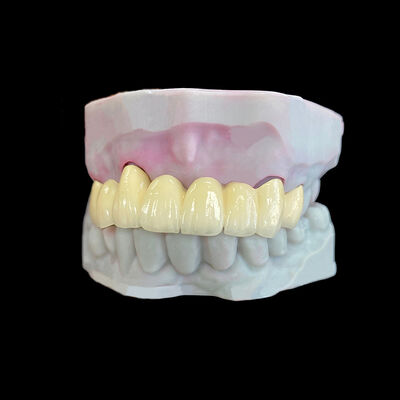 Bon prix Porcelaine fondue au métal (PFM) couronne avec cadre Co-Cr en ligne