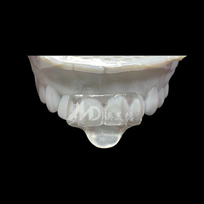 Bon prix Appareil d'orthodontie mini-garde de nuit personnalisé pour le bruxisme, la protection occlusive et le port de nuit confortable en ligne
