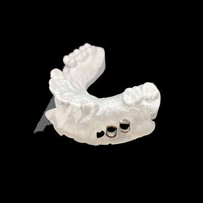Bon prix Guide de l'implant chirurgicale imprimé en 3D avec une résistance élevée à la décoloration à l'aide de la technologie de fraisage CAD / CAM en ligne