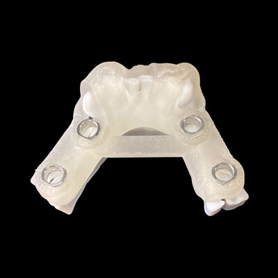 Bon prix Guide de chirurgie numérique des implants avec rapport de planification des implants en ligne