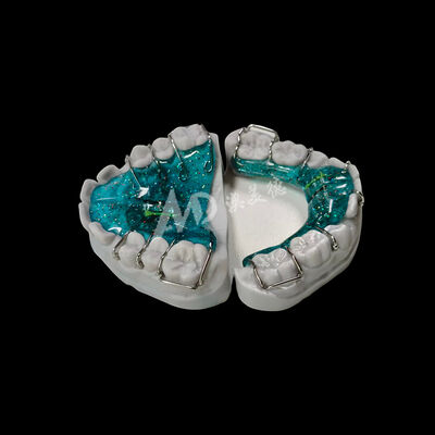 Bon prix Dispositifs orthodontiques à dilatation réglable Dispositifs amovibles sur mesure fournissant des solutions d'alignement des dents confortables En ligne