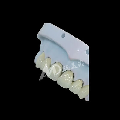 Bon prix Couronne dentaire en zircone monolithique à contour complet En ligne